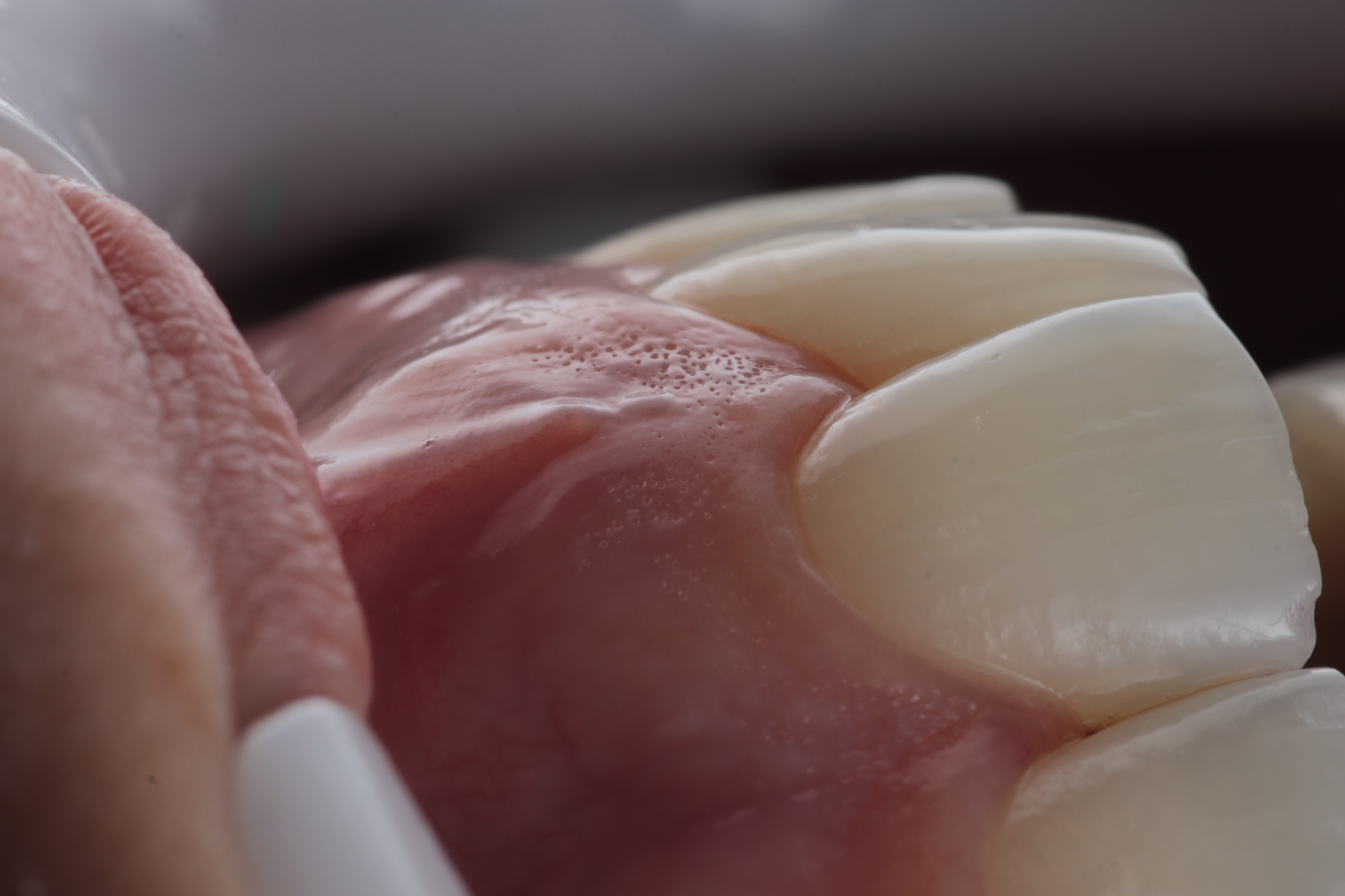 Periodoncia